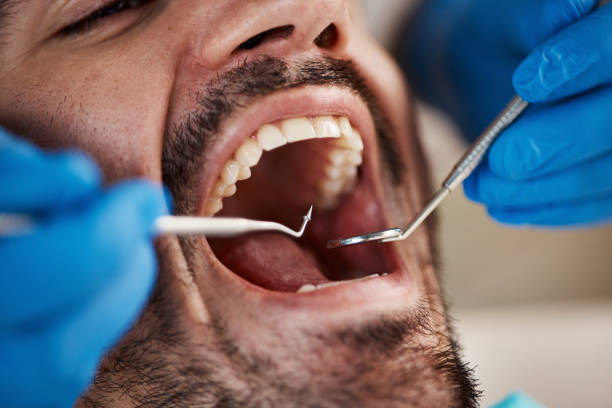 Best Urgent Tooth Repair  in Lake Tapps, WA