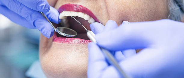 Best Knocked-Out Tooth Emergency  in Lake Tapps, WA